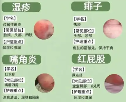拍一拍识别皮肤病app大全